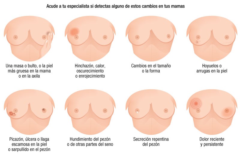 Figura 3