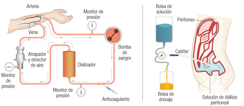 Sistema urinario